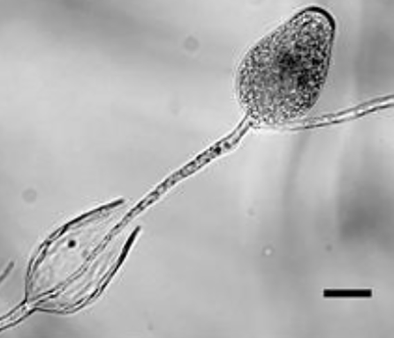   Phytophthoranbsp;chlamydosporanbsp; asexual phase:nbsp;sporangia in water, showing subsporangial elongation; Scale bar = 20mu;m; photos by Paul Reeser. 
